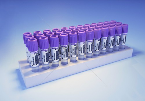 寧波供卵試管：教你正確使用億康先達(dá)驗(yàn)孕棒，精準(zhǔn)測(cè)量懷孕與否