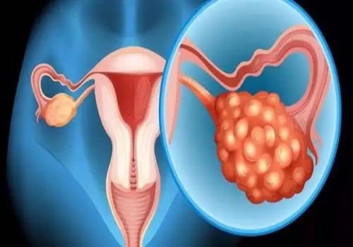 寧波試管助孕價(jià)格：怎樣通過(guò)孕檢單判斷胎兒性別？教你正確看懂孕檢單