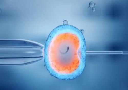 羊水穿刺染色體報(bào)告解讀：是男孩還是女孩一目了然！